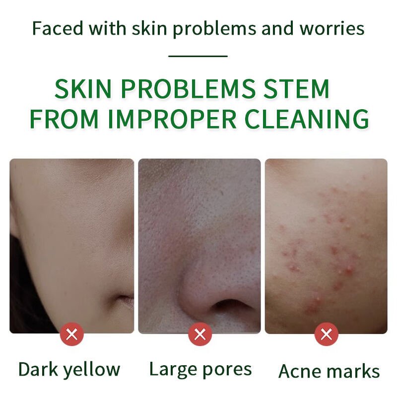 Handmade Soap Manufacturer - Herbal Faint Scent Argy Wormwood Extect Skin Whitening Nourishing & Custom Private Label Hot Selling