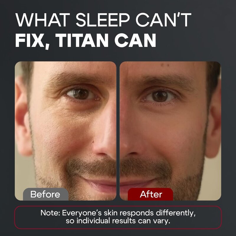 Eye Gel Manufacturer - 2025 OEM Vegan Korean Peptide Anti-aging Wrinkles Bags Removal for Men