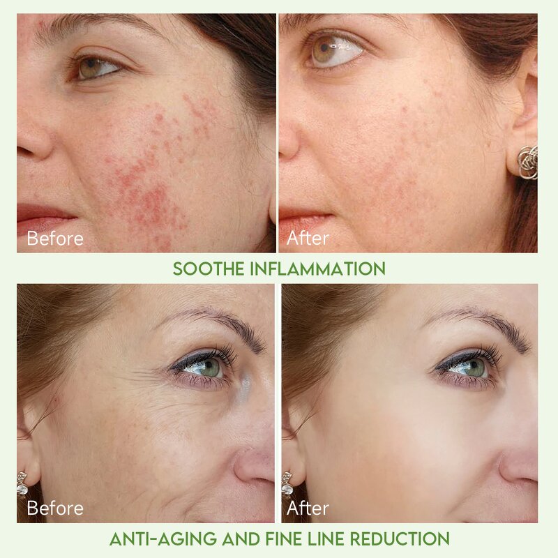 Face Care Cream Manufacturer - Korean Glass Skin Reduce Wrinkles Deep Hydration with Amla & OEM