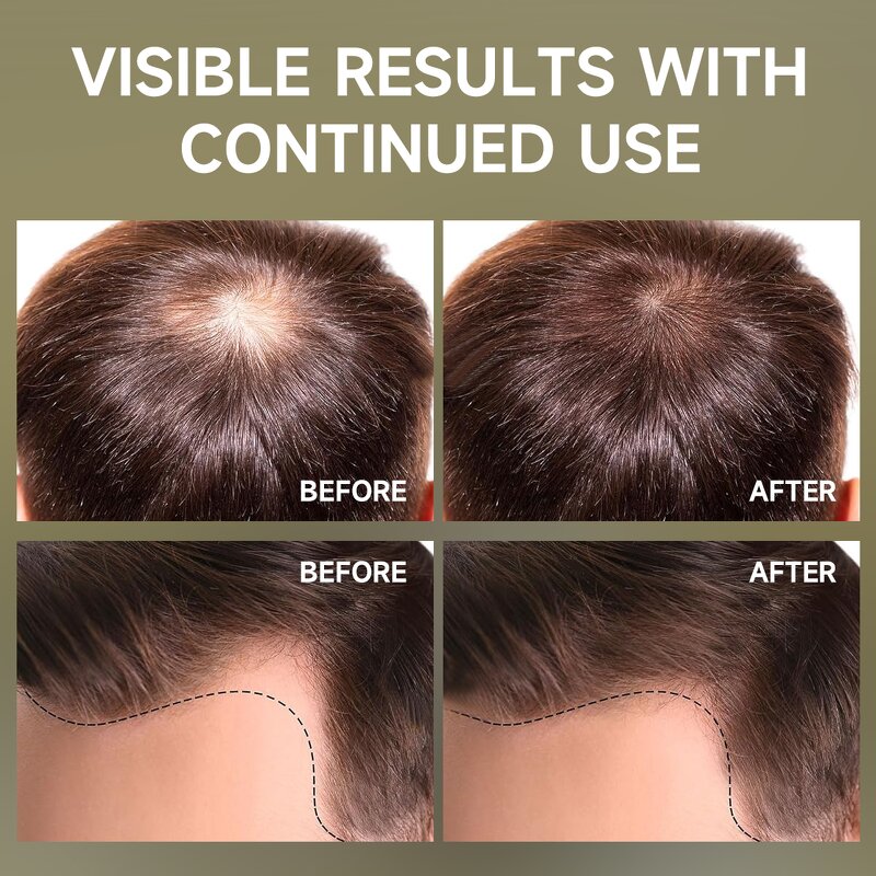 Hair Mask Manufacturer - Raw Batana Oil Organic Honduras Stimulate Hair Regrowth & Private Label Hot Sale