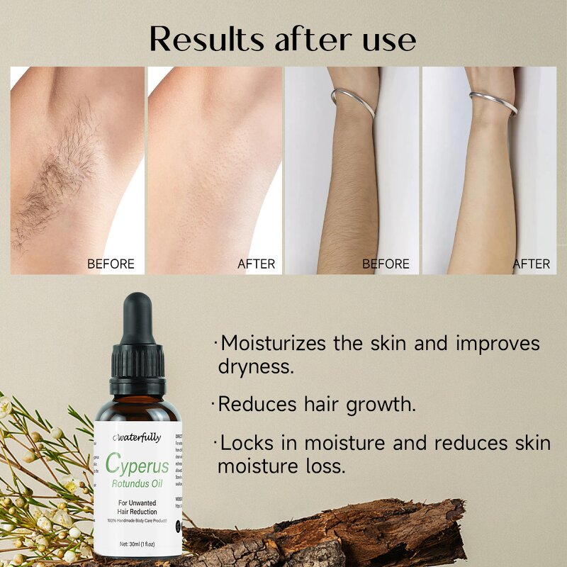 Essential Oil Manufacturer - 100% Pure Natural Organic Cyperus Rotundus for Skin Hair Removal & OEM Wholesale