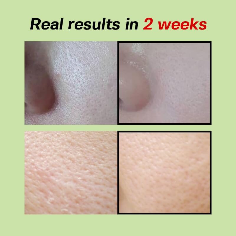 Face Serum Manufacturer - 30ml Tightening Smoothing Firming Deep Hydration Green Tomato & Private Label