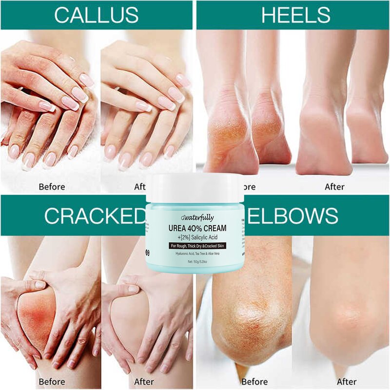 Foot Cream Manufacturer - Moisturizing Custom Moisture Organic for Cracked Heels & OEM