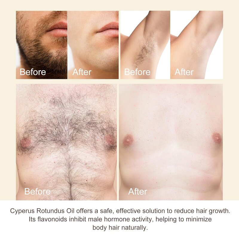 Essential Oil Manufacturer - 50ml 100% Pure Natural Cold Pressed Cyperus Rotundus for Hair Removal & Wholesale