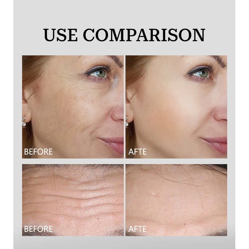 Face Moisturizer Manufacturer - Retinol Collagen Anti Aging Anti Wrinkle Firming with Vitamin C+E for All Skin Types