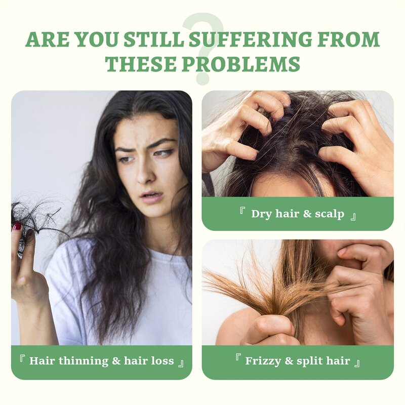 Shampoo Conditioner Manufacturer - Anti Dandruff Oil Control Organic Rosemary Tea Tree Oil Hair Growth & Wholesale