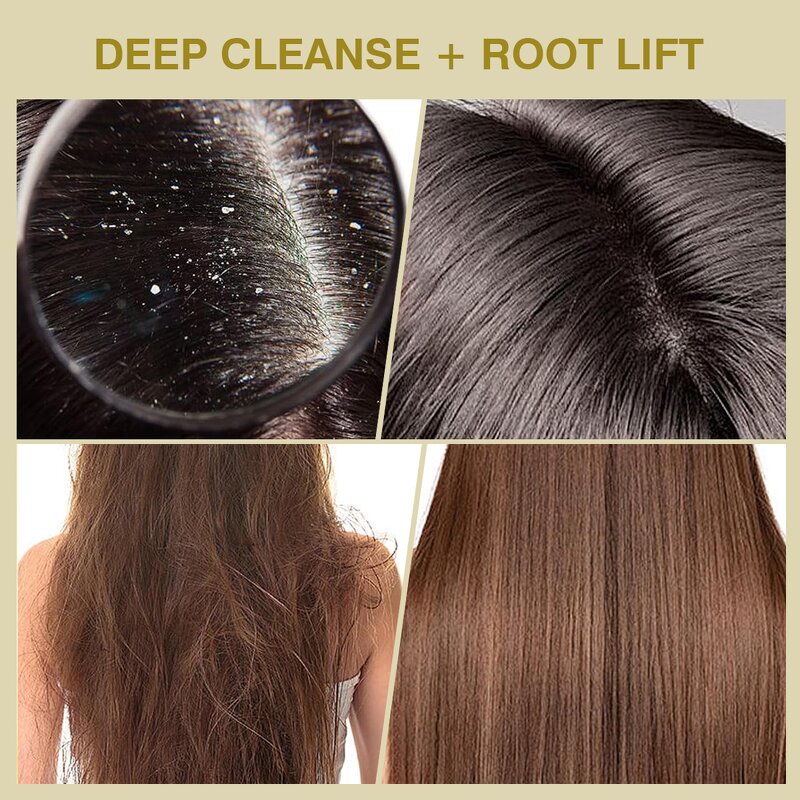 Scalp Scrub Cream Manufacturer - Protein Oceanic Essence Banana for Cleaning Care Reduce Dandruff Itching & OEM ODM