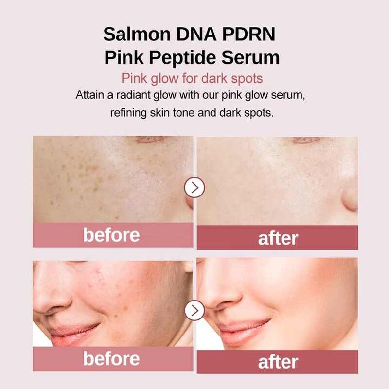 Peptide Serum Manufacturer - PDRN Pink with Niacinamide Hydrating for Dark Spots & Private Label Korean