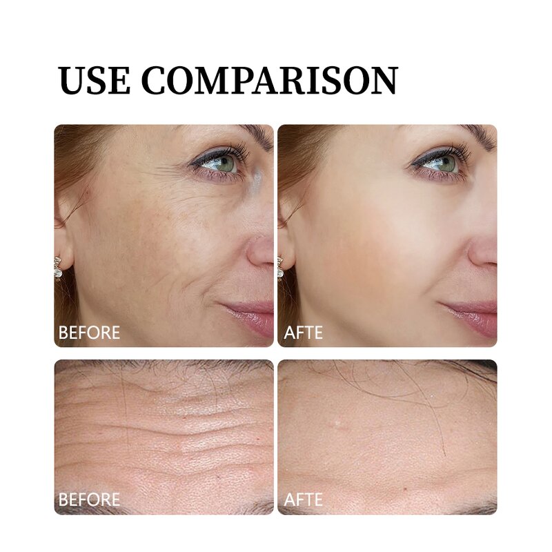 Face Serum Manufacturer - Formulated With Ceramide Hyaluronic Acid for Deep Soothing Hydration Accept OEM ODM & Custom Logo