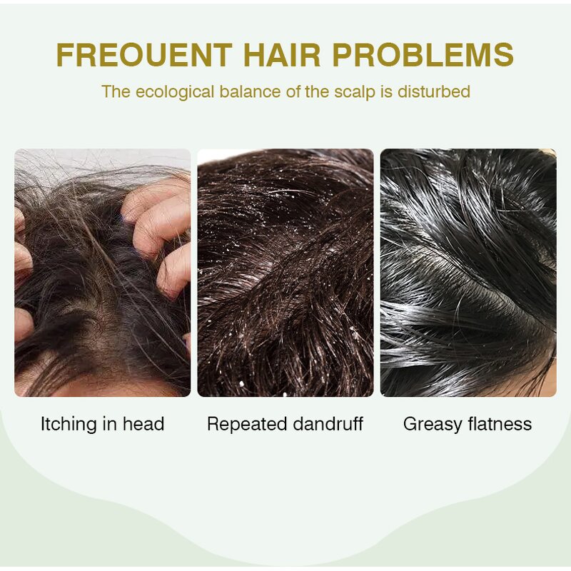 Scalp Scrub Cream Manufacturer - Protein Oceanic Essence Banana for Cleaning Care Reduce Dandruff Itching & OEM ODM