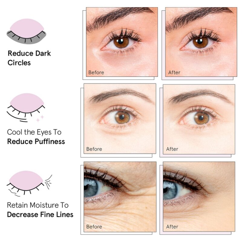 Eye Mask Manufacturer - 2025 Trending Collagen Hydrogel Organic Moisturizing Dark Circle Remove Under & Wholesale
