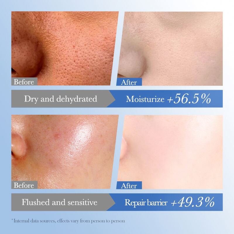 Skin Care Set Manufacturer - OEM New Best Seller Wholesale Collagen Kit Luxury Whitening All Skin Types