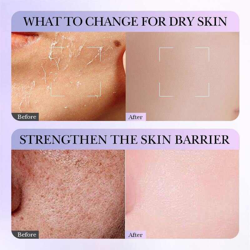 Facial Cleanser Manufacturer - OEM New Organic Coconut Oil Korean Cleansing Blackhead Control Soothing Oily Skin