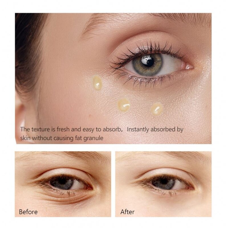 Face Serum Manufacturer - Natural Organic OEM Retinol Vitamin C Hyaluronic Acid Deep Moisturizing Anti-aging Set