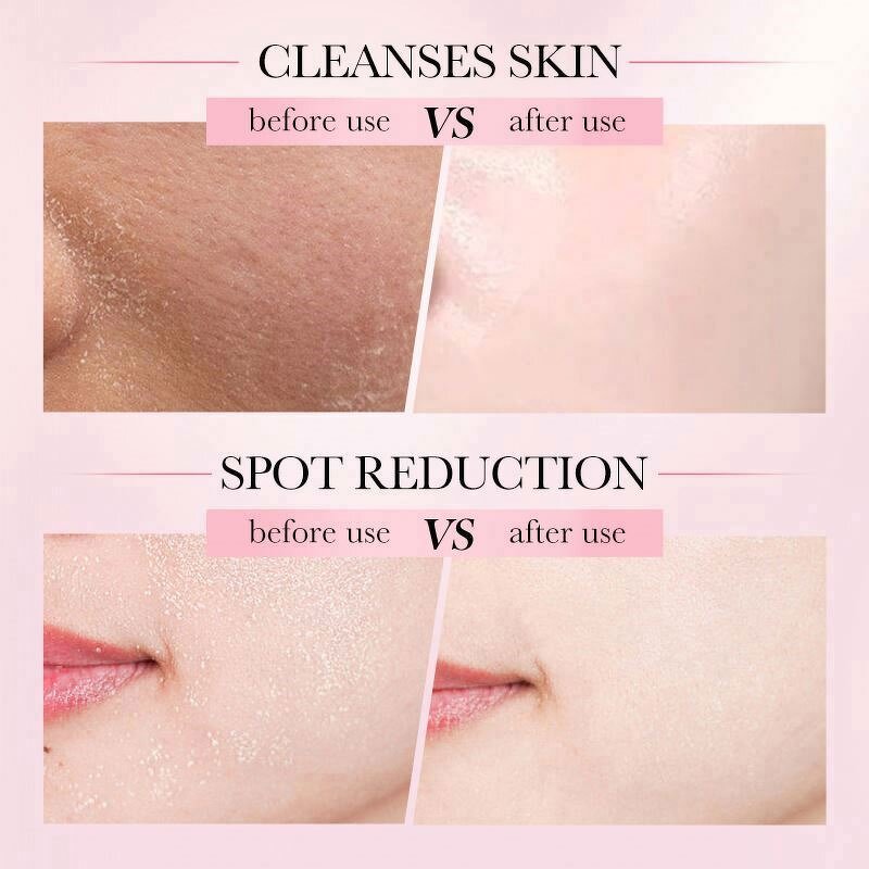 ZOZU Face Serum Manufacturer - Vitamin C Hyaluronic Acid Remover Freckles Anti-aging Whitening