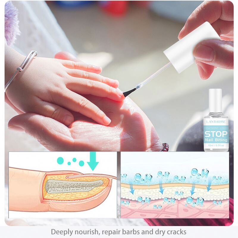 Nail Treatment Manufacturer - Paronychia Onychomycosis Feet Care Nail Foot Whitening Toe Fungus Removal Gel