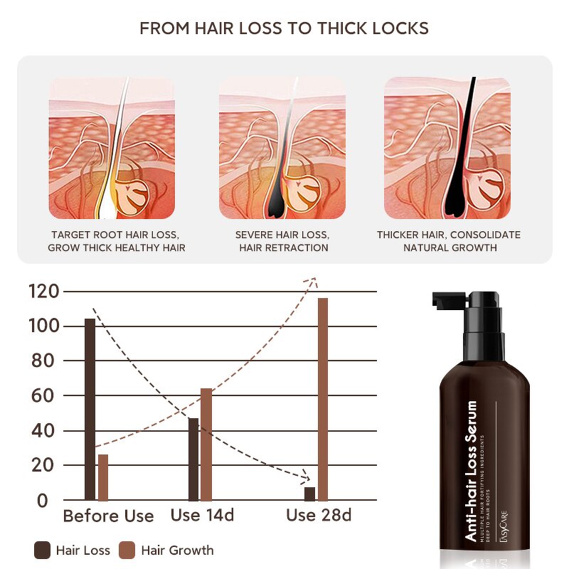 Scalp Serum Manufacturer - Fast Repair Regrowth Anti-Hair Loss with Caffeine Reduces Breakage