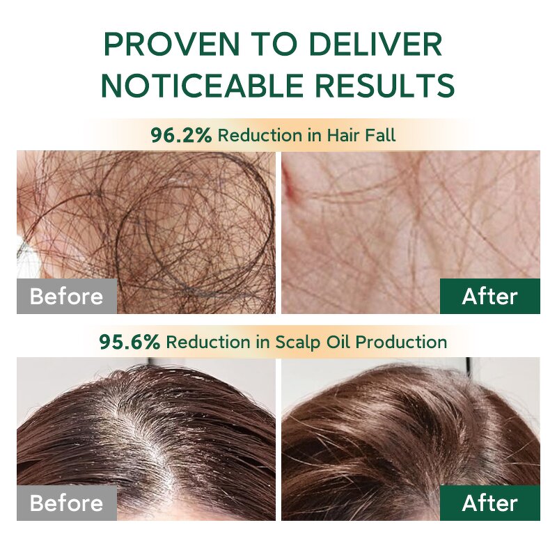 Shampoo Manufacturer - Custom 400ml Natural with Turmeric Black Tea Improves Scalp Anti-Hair Loss