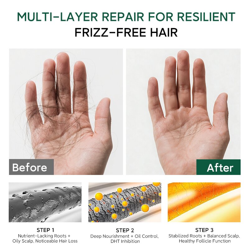 Shampoo Manufacturer - Custom 400ml Natural with Turmeric Black Tea Improves Scalp Anti-Hair Loss