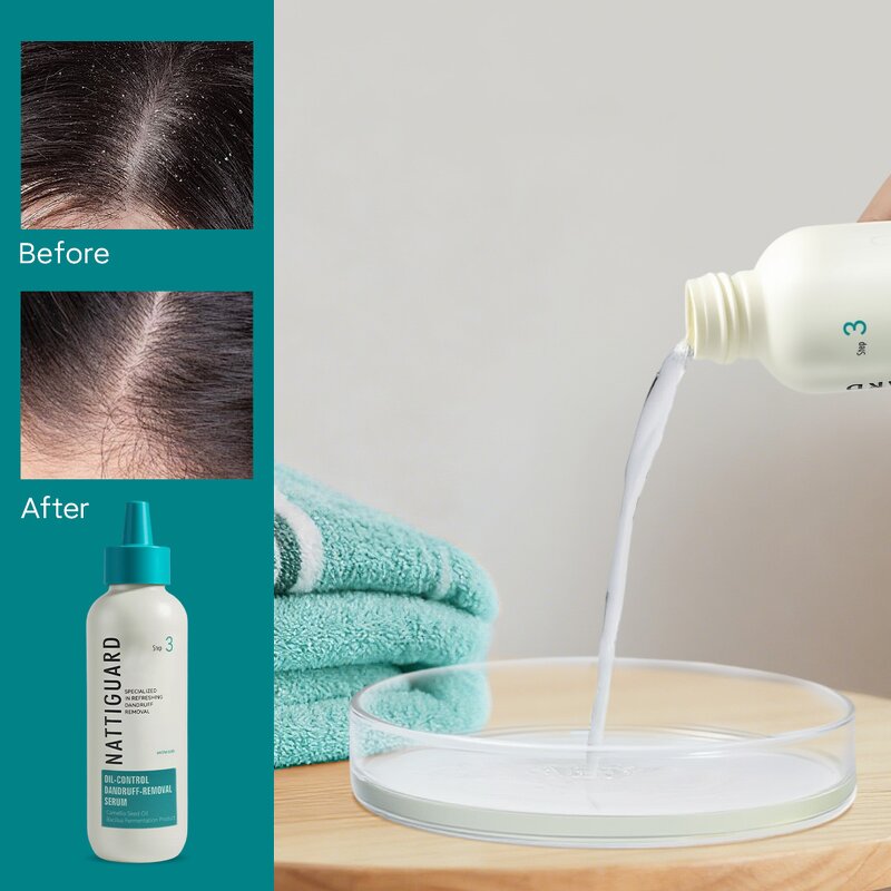 Scalp Serum Manufacturer - High Quality Nattiguard Instant Oil Control with Sodium Salicylate