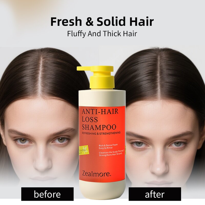 Shampoo Manufacturer - Hot Selling Zealmore Oil-water Balance with Ginseng Ginger Hair Loss Prevention