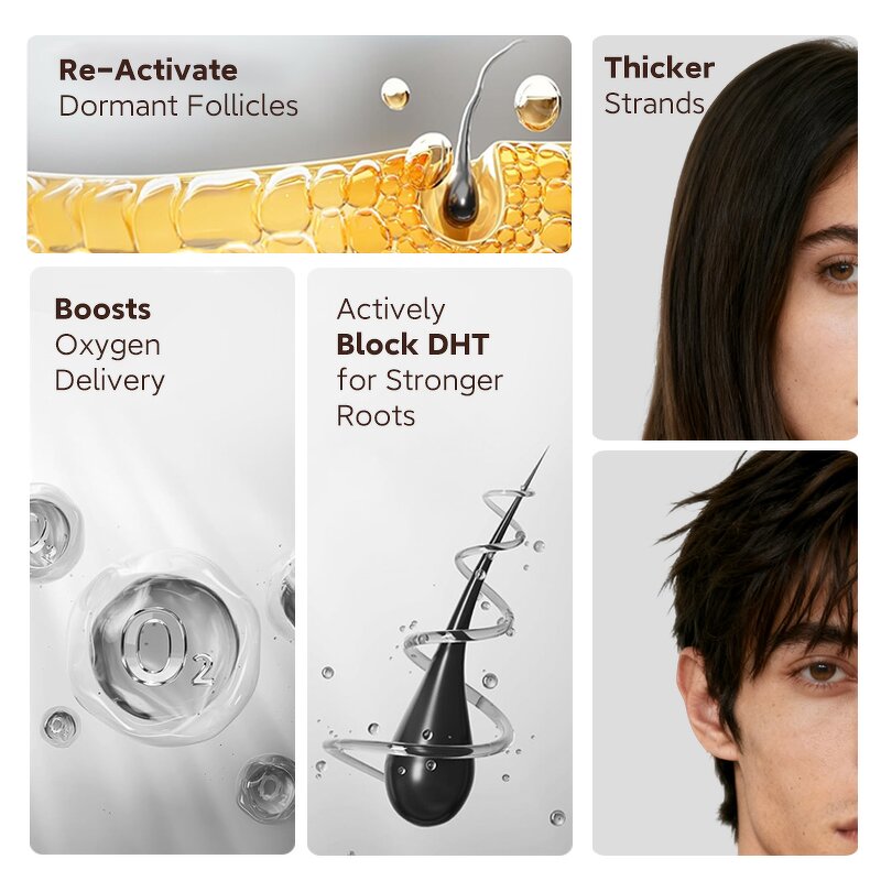 Hair Growth Serum Manufacturer - In Stock 15ml Roll on with Saw Palmetto Rosemary Argan Oil