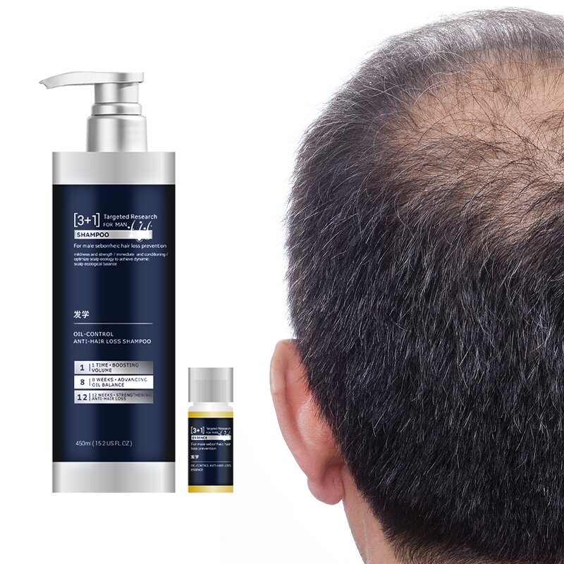 Shampoo Manufacturer - Private Label Anti Hair Loss Scalp Treatment for Men Thickening