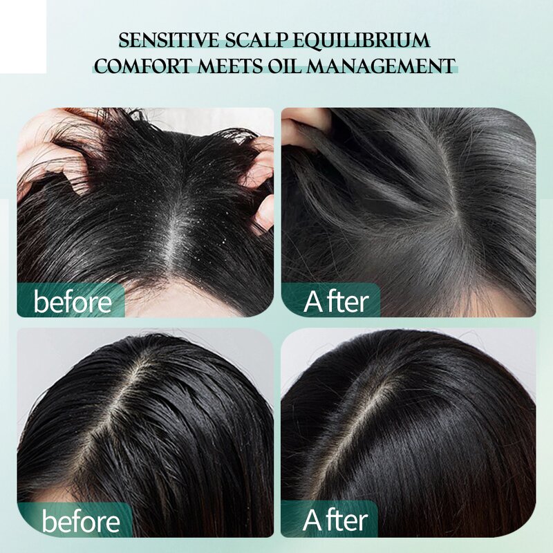 Shampoo Manufacturer - Wholesale Nattiguard Anti-Dandruff Sebum Control Hydrating for Sensitive Scalp