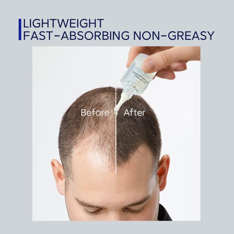 Anti-hair Loss Set Manufacturer - Wholesale Nattiguard with Keratin & Adenosine Oil Control for Man