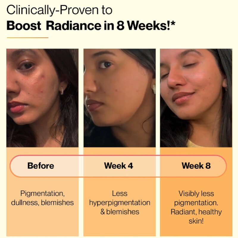 Herbal Supplement Manufacturer - Organic Elderberry Immune Vitamin C Adult Herbal