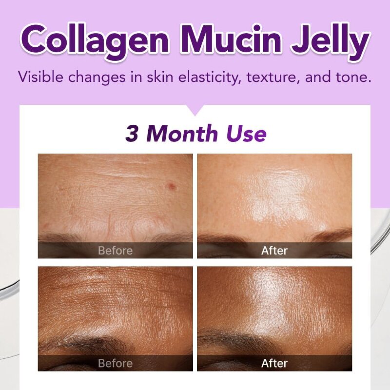 Weight Loss Supplement Manufacturer - OEM Organic Sugar-Free Slim Digestive Adult