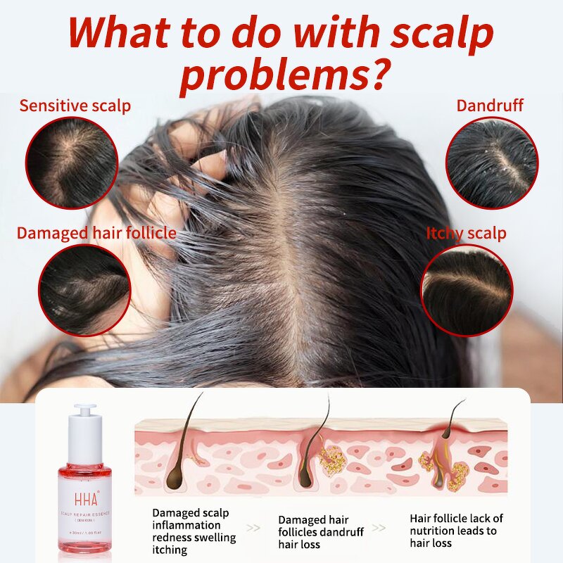 Hair Serum Manufacturer - OEM Natural Green Ginger Scalp Repair Boost Growth Oil Loss Recovery Herbal