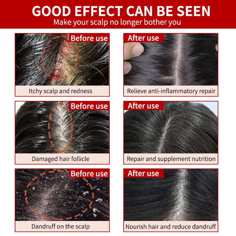 Hair Serum Manufacturer - OEM Natural Green Ginger Scalp Repair Boost Growth Oil Loss Recovery Herbal