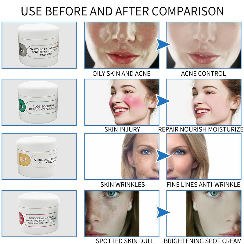 Face Mask Manufacturer - Collagen-Based Anti-Acne White Mud Mask Aloe Soothing Repair Oil Control Acne Removal