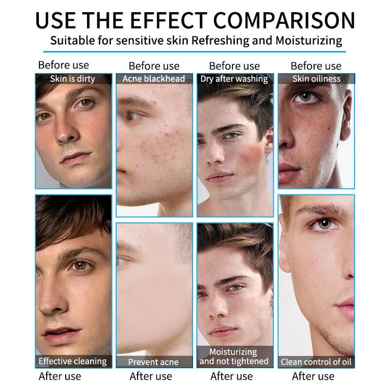 Hair Serum Manufacturer - Organic Herbal Hair Loss Men Clinically Proven Anti-Shedding Scalp Repair Regrowth