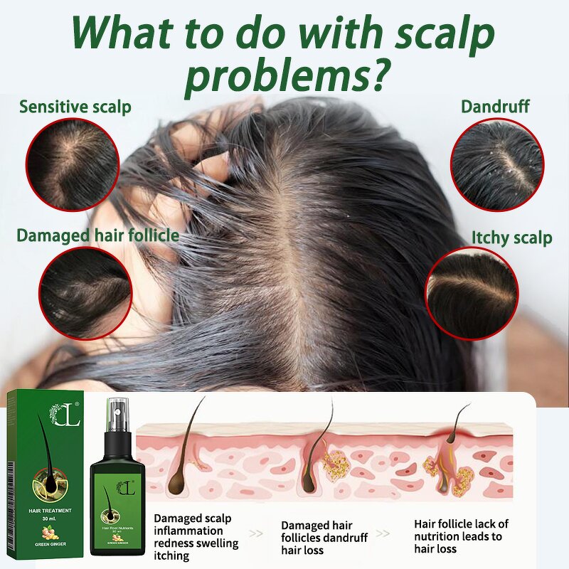 Hair Serum Manufacturer - OEM Natural 120ML Green Ginger Scalp Repair Boost Growth Oil Loss Recovery