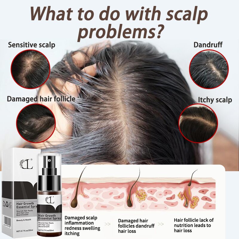 Hair Spray Manufacturer - ODM Herbal Instant Hair Grow Wholesale Hair Treatment Prevention Hair Loss