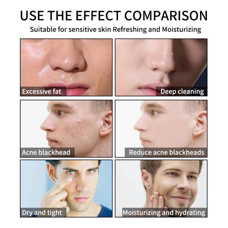 Peel Mask Manufacturer - OEM Custom Activated Charcoal Mint Deep Pore Cleansing Detoxifying Oil Control Men