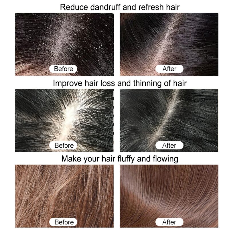 Peel Mask Manufacturer - Custom Activated Charcoal Deep Pore Cleansing Detoxifying Blackhead Remover Men Mint