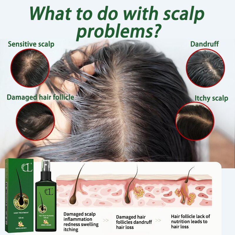 Hair Growth Spray Manufacturer - 20ml Natural Effective Herbal Concentrated Formula Soothe Sensitive Scalp