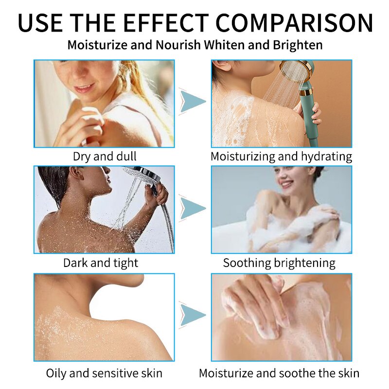 Body Lotion Manufacturer - Powerful 300ML Hyaluronic Acid Whitening Dark Spot Removal Moisturizing Daily