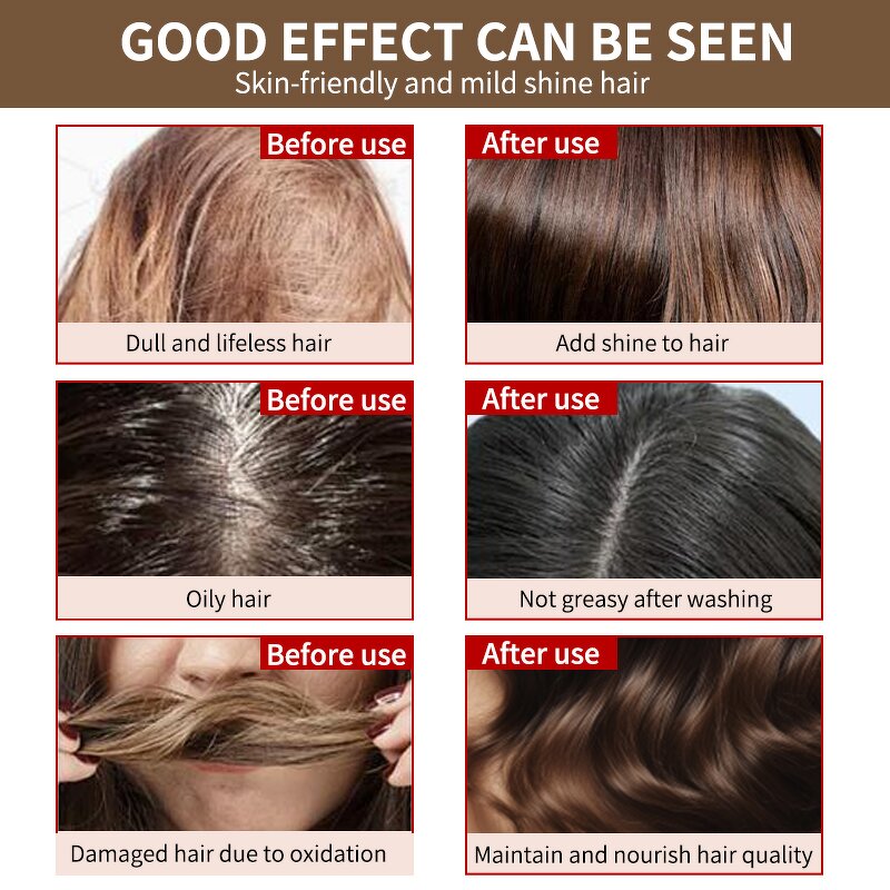 Scalp Serum Manufacturer - ODM Professional Natural Green Ginger Essence Hair Treatment Boost Growth Oil Loss