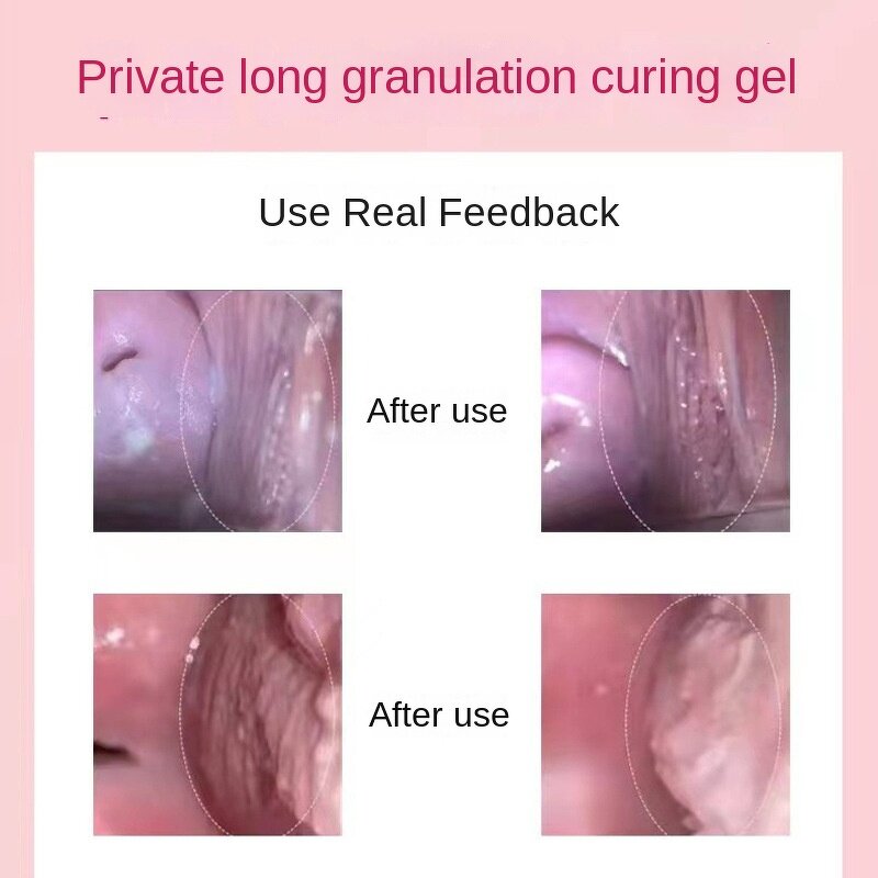 Peptide Gel Manufacturer - OEM Intimate Ladies with Small Molecule Egg Yolk Oil for Tightening