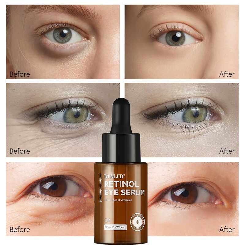 Eye Serum Manufacturer - MMJD Wholesale Anti-Aging Retinol Lightening for Fine Lines Reduction