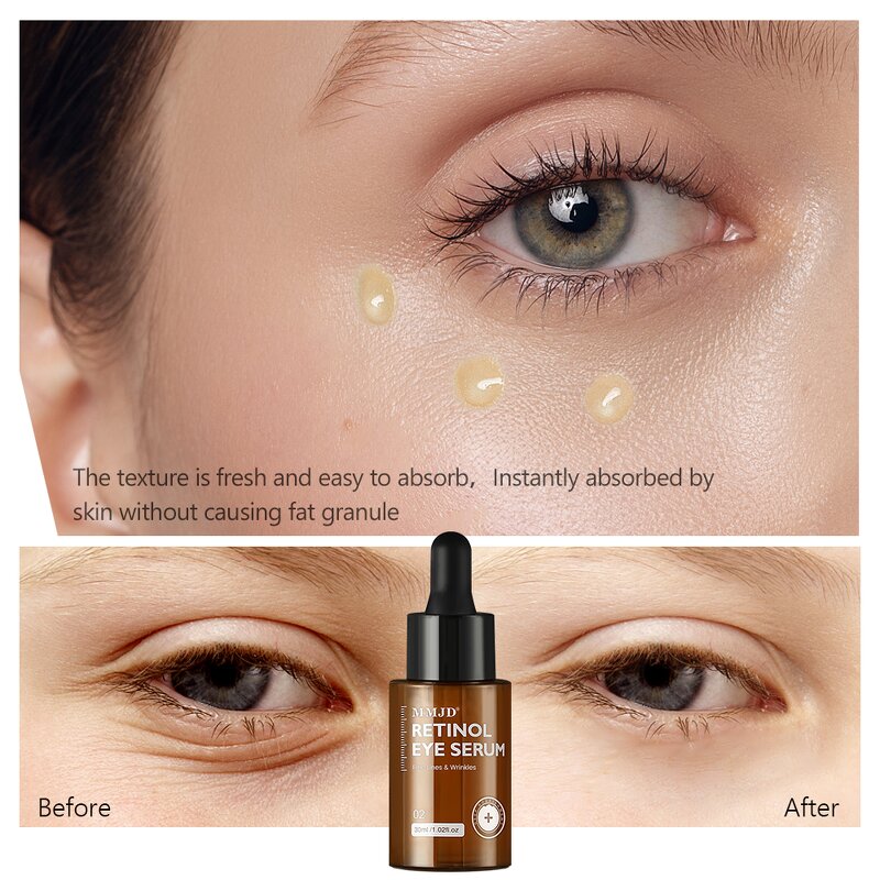 Eye Serum Manufacturer - MMJD Wholesale Anti-Aging Retinol Lightening for Fine Lines Reduction