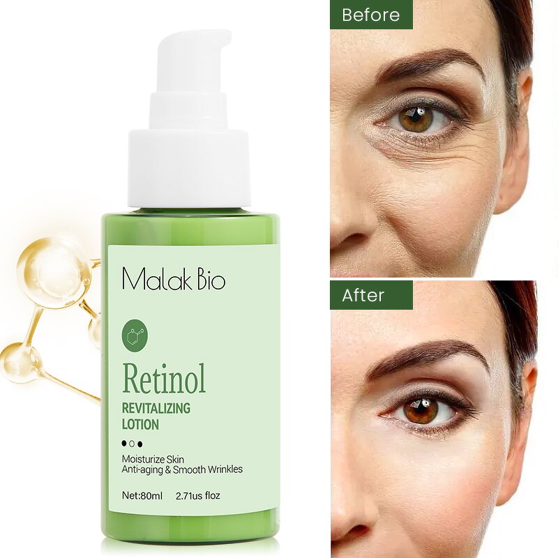 Cosmetic Emulsion Manufacturer - New Popular Fashion Gentle Magic to Improve Rough Skin