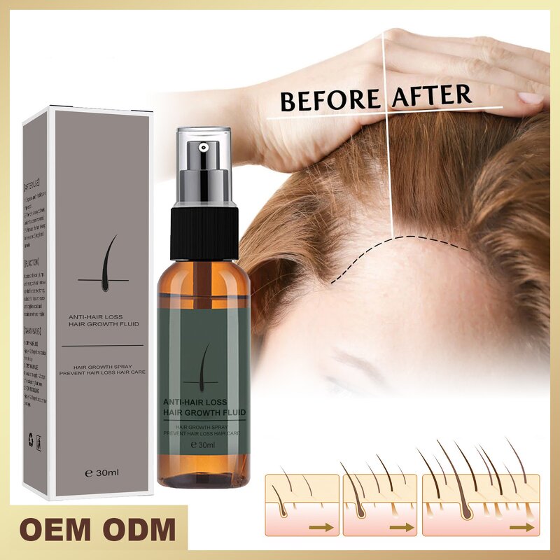 Hair Care Essential Oil Manufacturer - Wholesale 60ml Rosemary 100% Plant for Growth Strengthening