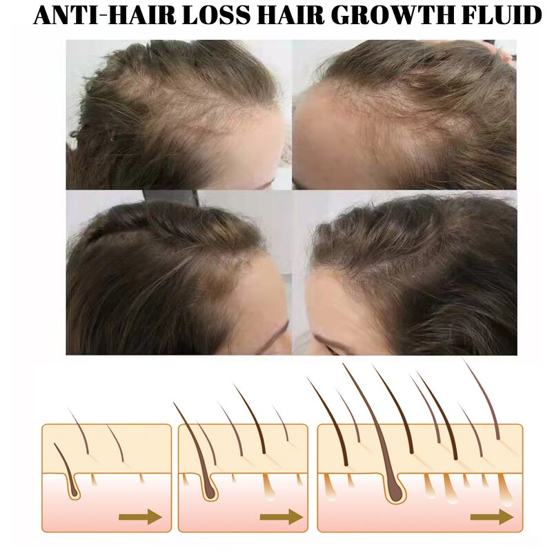 Hair Care Essential Oil Manufacturer - Wholesale 60ml Rosemary 100% Plant for Growth Strengthening