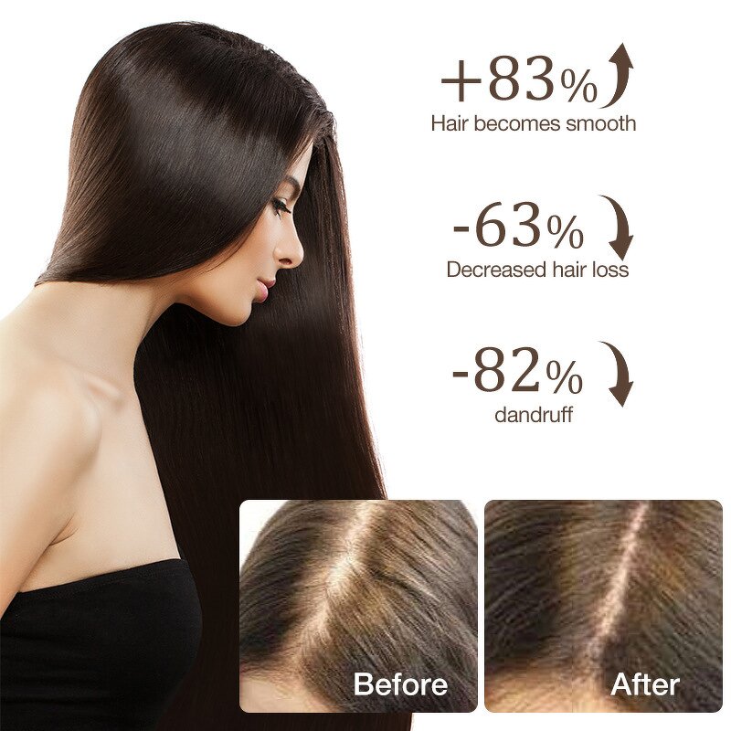 Ginger Shampoo Manufacturer - OEM Herbal for Home Use Prevents Hair Loss Controls Oil Soothes