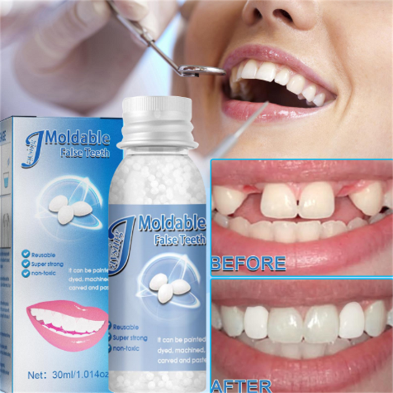 False Teeth Gel - OEM Moldable Temporary Fill Fix Missing Broken Teeth Gel